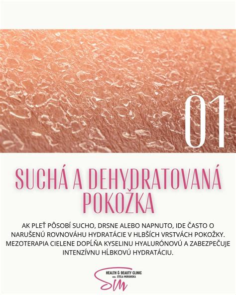 Ilustrácia správnej hydratácie pokožky nôh