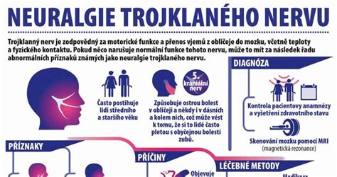 Schéma trojklaného nervu