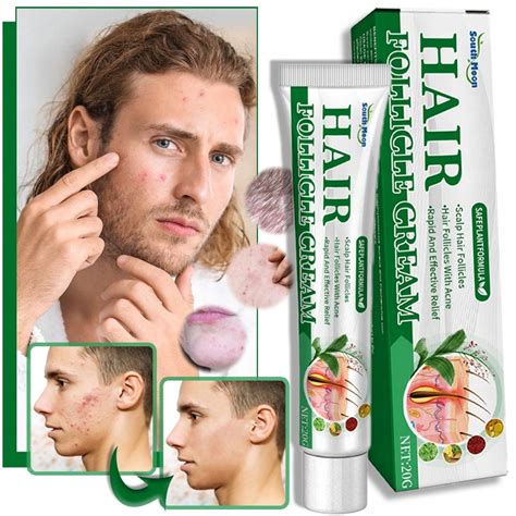 Porovnanie zdravých a vypadávajúcich vlasových folikulov