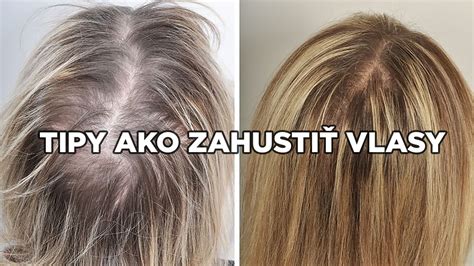 Porovnanie účesov pre riedke vlasy a plešatosť