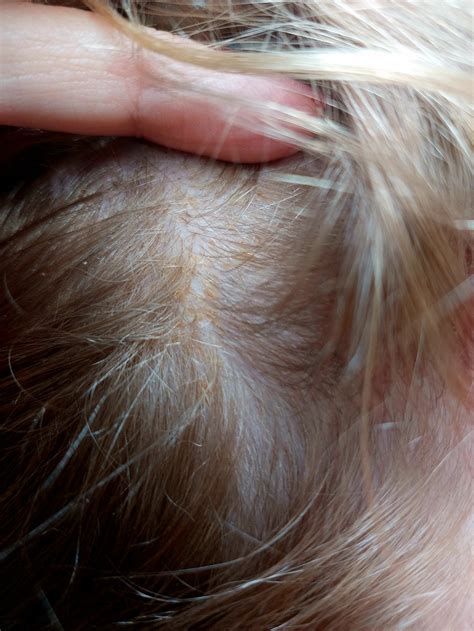 Žlté odlesky vo vlasoch