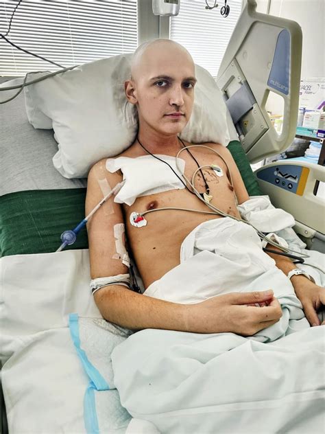 Fotografia Timei, pacientky s leukémiou