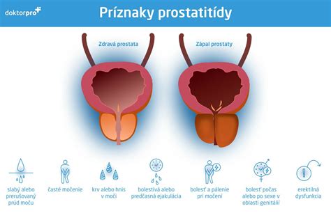 Infografika o potenciálnych rizikách spojených s holením podpazušia