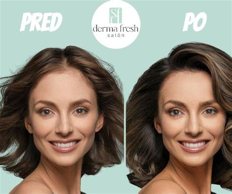 infografika porovnávajúca stav vlasov pred a po použití šampónu proti lupinám