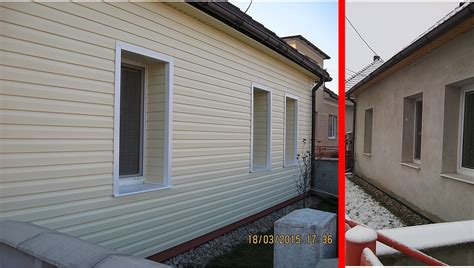 Porovnanie vzhľadu pred a po estetických úpravách