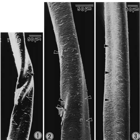 Schéma pôsobenia vlasového botoxu na štruktúru vlasu