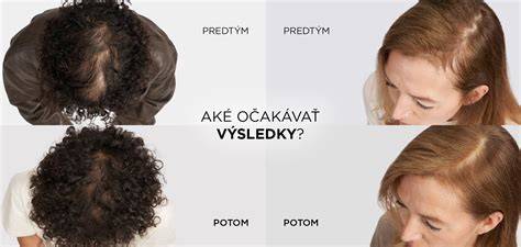 Ilustrácia poškodených vlasových vlákien