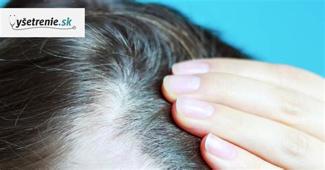 Porovnanie šampónov na rednutie vlasov