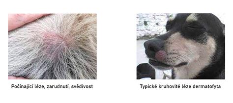 Schéma účinku antimykotík na kožné ochorenia