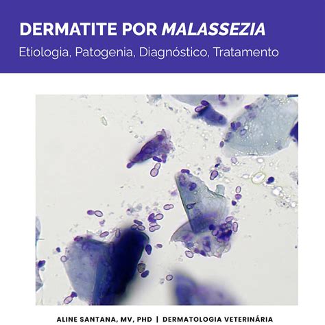 Ilustrácia kvasiniek Malassezia