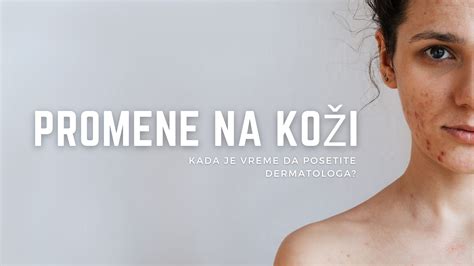 Porovnanie trvanlivosti henny na koži a chĺpkoch