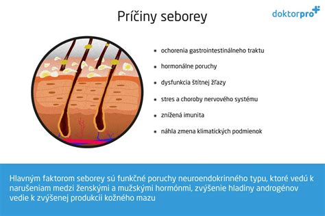 Schéma príčin vzniku seboroickej dermatitídy