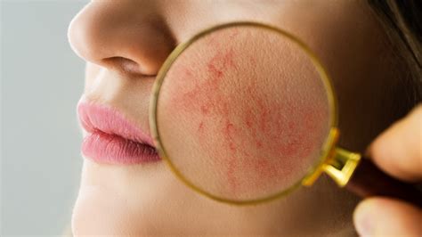 Žena s nadmerným ochlpením na tvári