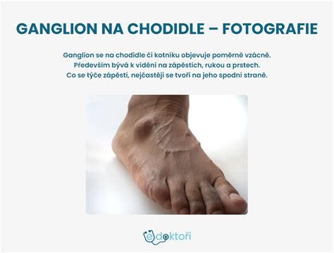 Hotový vzor mehendi na chodidle po 48 hodinách