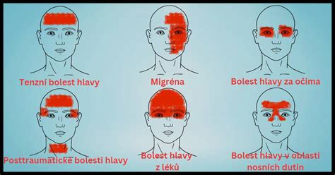 Porovnávacia schéma rotačnej a planžetovej hlavy