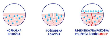 Vizualizácia suchej a podráždenej atopickej pokožky
