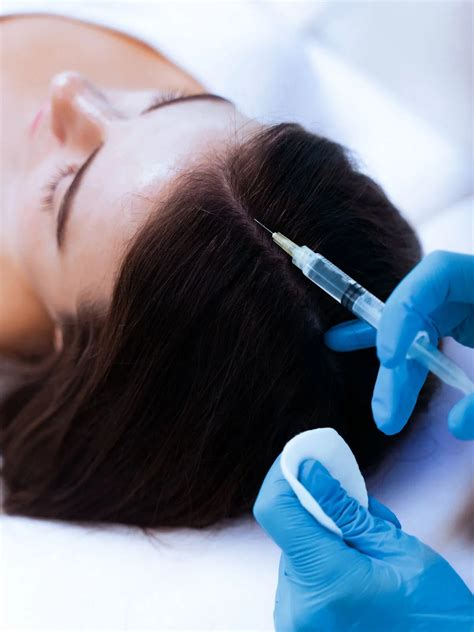 Mezoterapia vlasovej pokožky