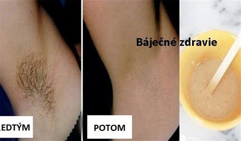 Ilustrácia hladkej pokožky v podpazuší