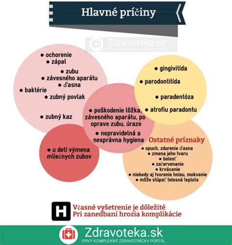 Graf: Príčiny a prevencia kývania zubov