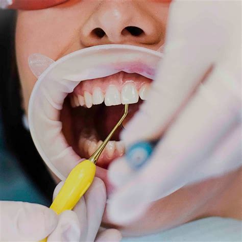 Hygiena pri brazílskej depilácii