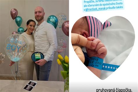 Fotografia hlavičky bábätka s mliečnou chrastou