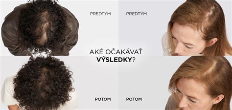 Ilustrácia zdravej stravy pre hustejšie vlasy