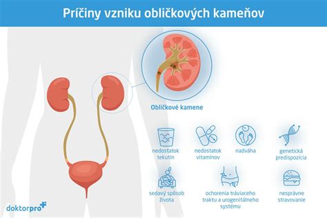 Príčiny vzniku lupín