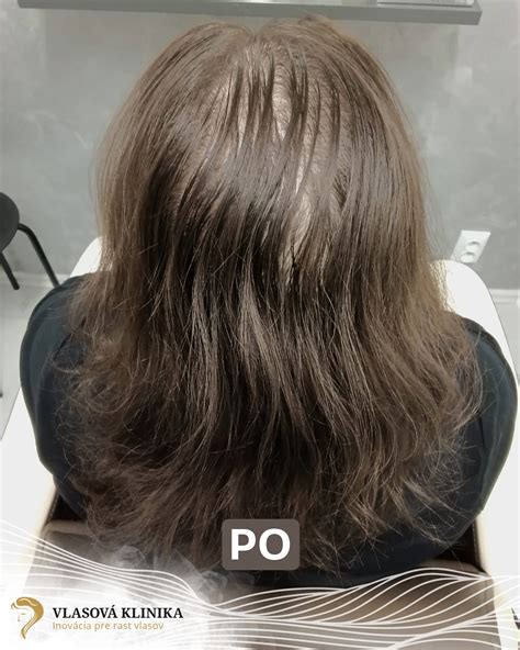 spokojná klientka po profesionálnej úprave vlasov