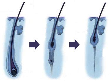 schéma štruktúry vlasového folikulu a rastového cyklu vlasu