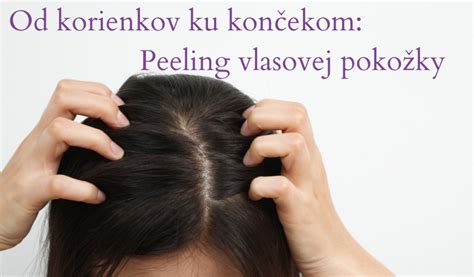 Detail vlasovej pokožky a rastu vlasov
