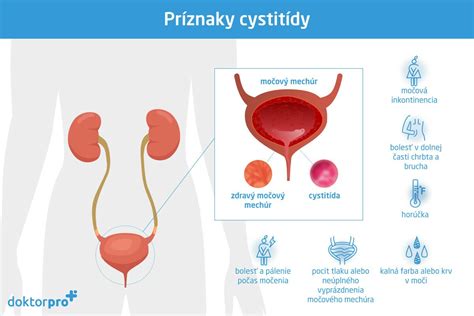 Typy úpravy intímneho ochlpenia u mužov
