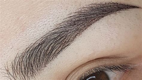 Fázy hojenia obočia po čiarkovanej metóde