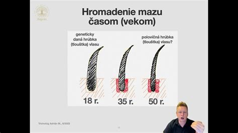 Štruktúra vlasovej pokožky a folikulu