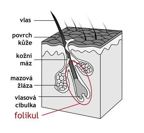 Schéma pôsobenia IPL technológie na vlasový folikul