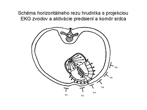 Schéma rezu kríčkových ríbezlí pre optimálnu rodivosť