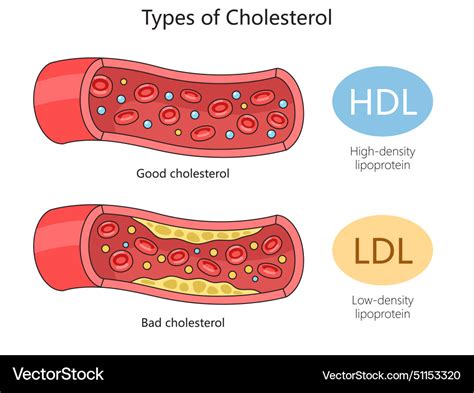 schéma LDL a HDL cholesterolu v cievach