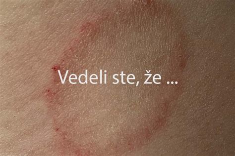 Kožné ochorenia v podpazuší