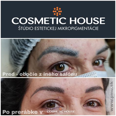 medicínska mikropigmentácia