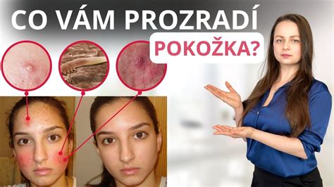 Porovnanie pred a po použití depilačného krému