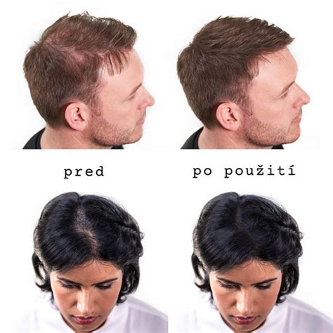 Vizuálne porovnanie rednúcich vlasov pred a po použití zahusťovača