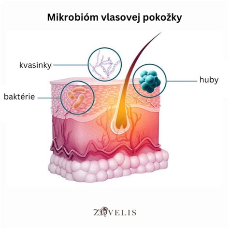Ilustrácia mazových žliaz na pokožke hlavy