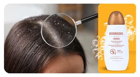 schéma pôsobenia šampónu na pokožku hlavy