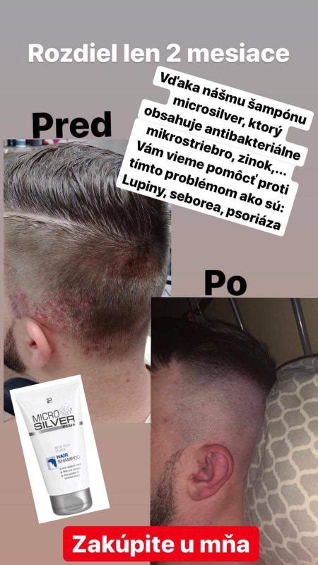 Schéma znázorňujúca proces straty a obnovy pigmentov vo vlasoch pri zmene farby