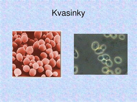 Schéma pôsobenia kvasinky Malassezia na kožný maz