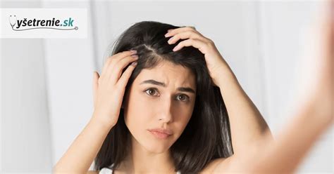 ilustračná fotografia ženy s podráždenou pokožkou hlavy