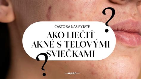 postup prípravy pleti pred epiláciou schéma