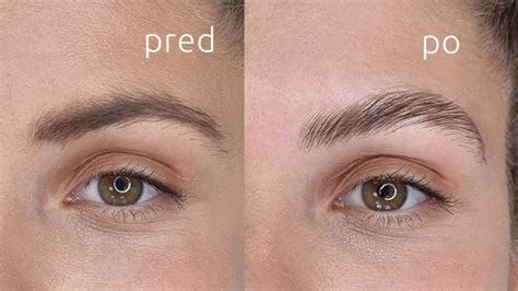 porovnanie pred a po aplikácii permanentného obočia