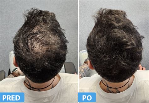 Schéma účinku Healing Bond na vlasové vlákna