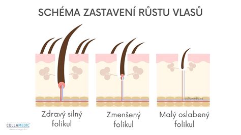 Schéma pôsobenia svetelného impulzu na vlasový folikul