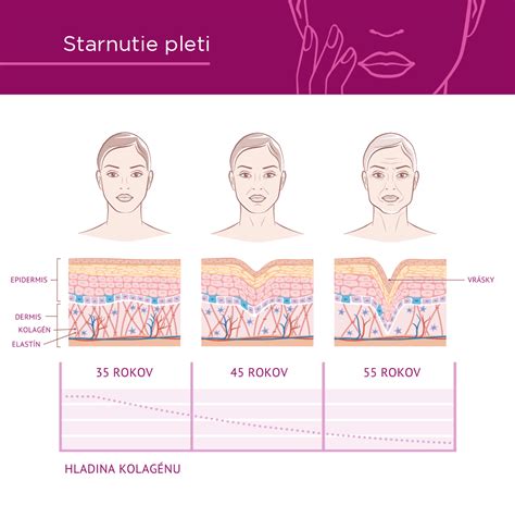 Infografika o rôznych typoch pleti a ich charakteristikách